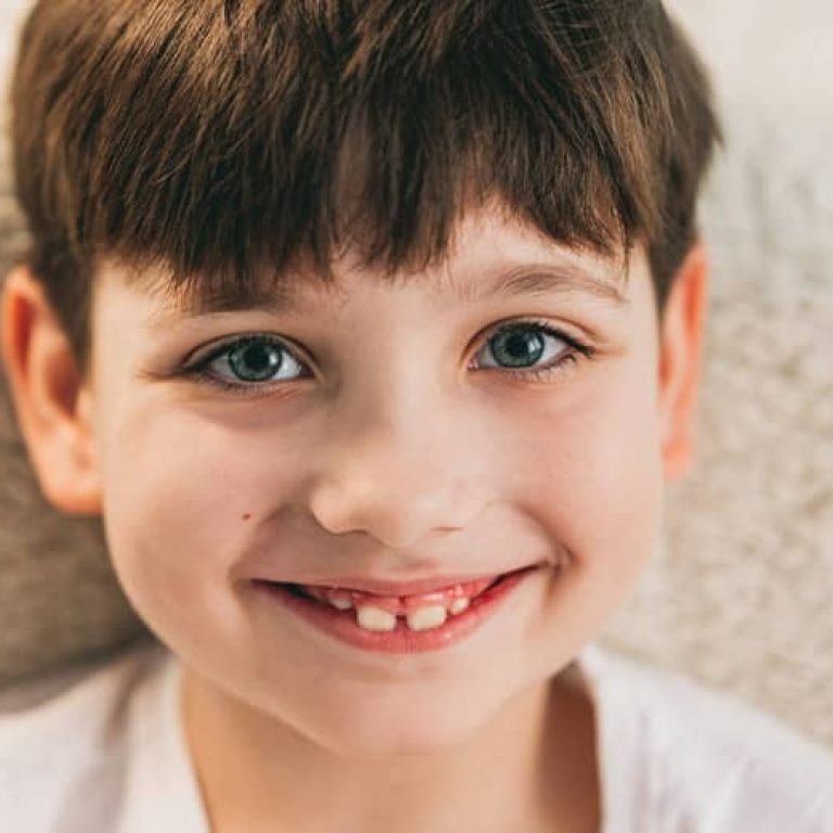 odontopediatria-en-Clinica-Dental-Benicasim